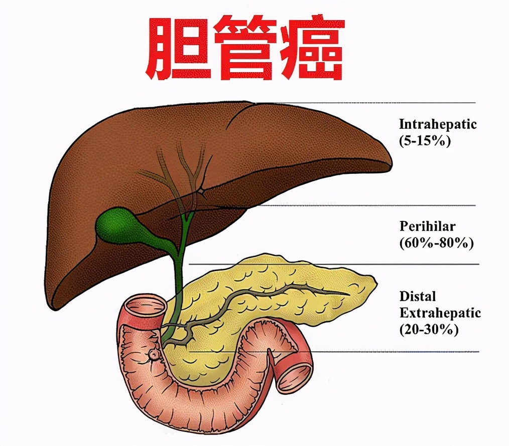 三大靶点，五大药物，吹响胆管癌新药集结号